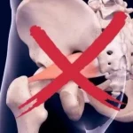 bokong lemah pada pelari