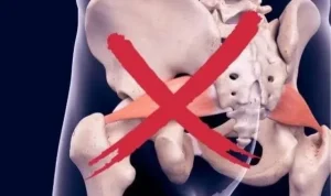 bokong lemah pada pelari