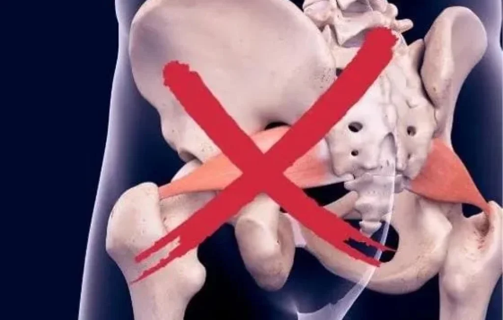 bokong lemah pada pelari