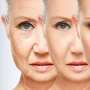 peremajaan kulit tanpa operasi